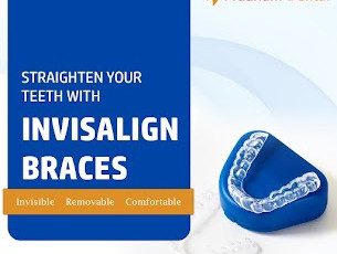 Invisalign Treatment In Hyderabad