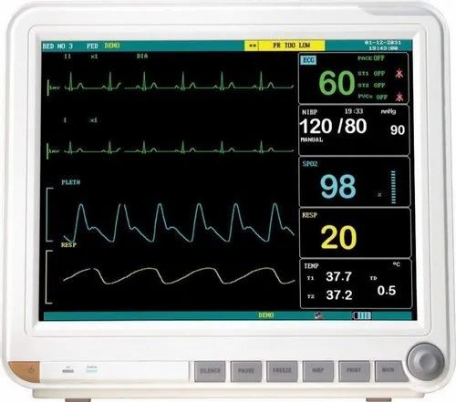 Multipara Monitor