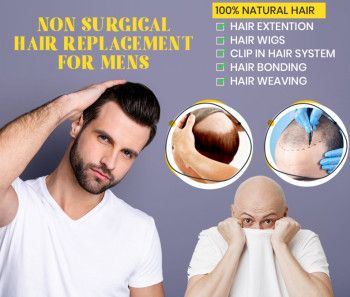 Non Surgical Hair Replacement