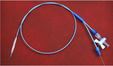 Ureteral Balloon Dilator