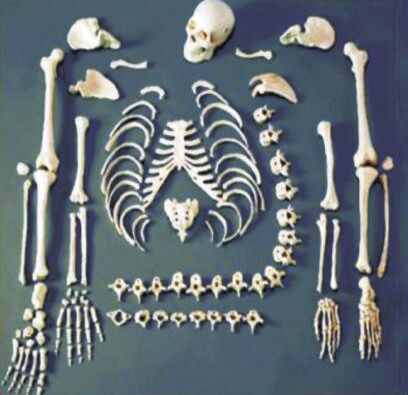 Disarticulated Human Skeleton
