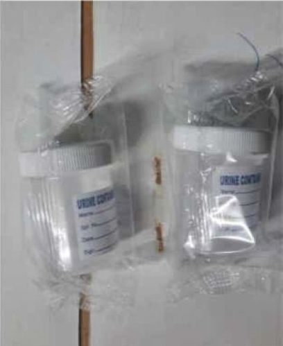 Polypropylene 60 ML Urine Container, For Laboratory, Feature : Disposable, Durable, Light Weight