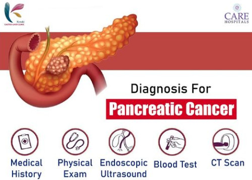 Pancreatic Cancers Treatment Service