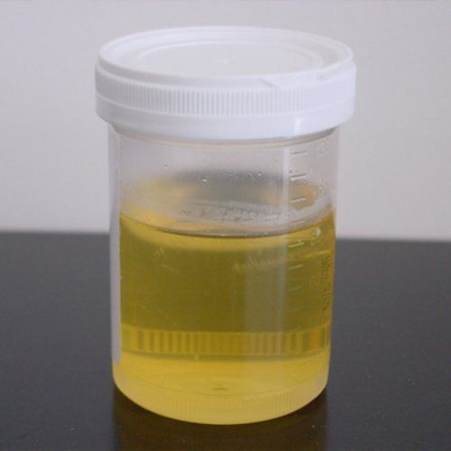 Donkey Urine, Color : Pale Yellow, Packaging Type : Bottle For Cardiac Disease