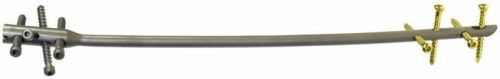 Retrograde Femoral Nail, Size : 16cm To 42cm