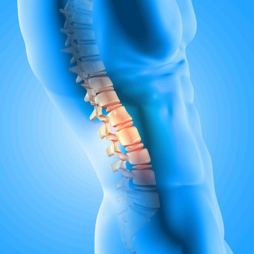 Conservative- Nonoperative Management For Osteoarthritis