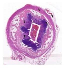 Appendix Prepared Histology Glass Slide Standard For Clinical, Laboratory