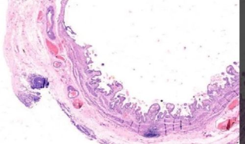 Transparent Rectangular Plain Clonorchiasis Gall Bladder, For Clinical, Laboratory, Size : Standard