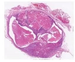 Transparent Rectangular Digital Slides Of Lymphoreticular System, For Clinical, Laboratory, Size : Standard