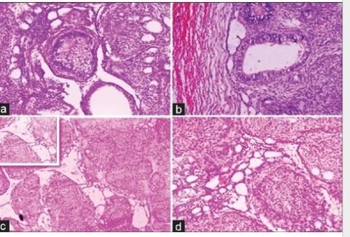 Transparent Rectangular Digital Slides Of Odontogenic Tumors, For Clinical, Laboratory, Size : Standard