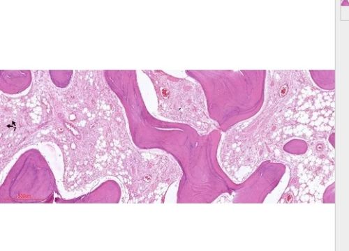 Transparent Rectangular Digital Slides Of Bony Tumors, For Clinical, Laboratory, Size : Standard