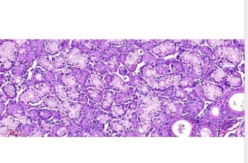 E Slide Of Epithelial Lesions, For Clinical, Laboratory, Feature : Eco Friendly, Superior Quality