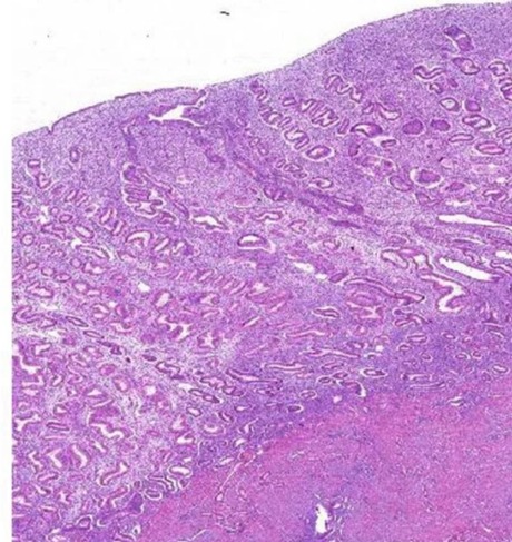 Rectangular Endometrium Uterus Prepared Microscope Slide, For Clinical, Laboratory, Size : Standard