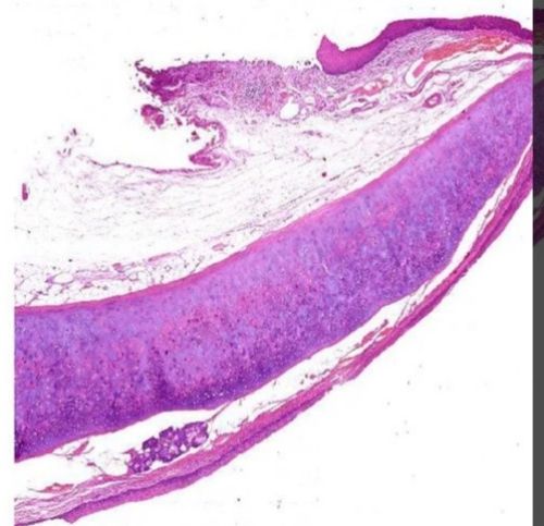 Plain Epiglotis Prepared Microscope Slide, For Clinical, Laboratory, Feature : Eco Friendly, Superior Quality