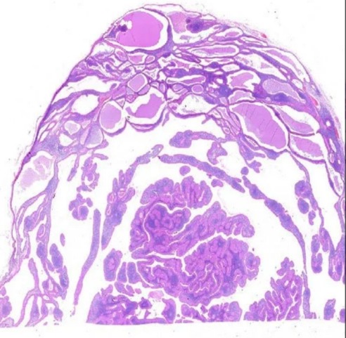 Transparent Rectangular Epithelial Tumour Digital Slides Set, For Clinical, Laboratory, Size : Standard