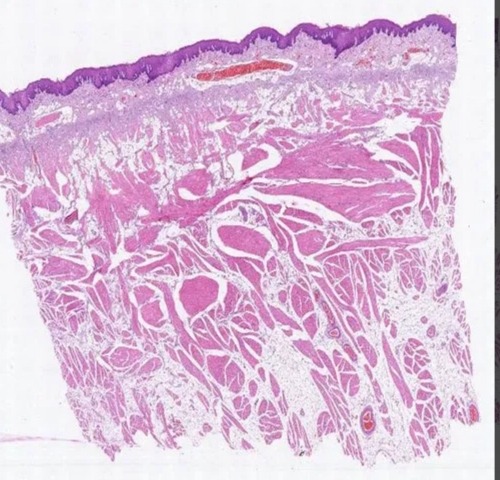 Human Histology Prepared Microscopic Glass Slide, For Chemical Laboratory, Pathology Lab, Packaging Type : Plastic Packets