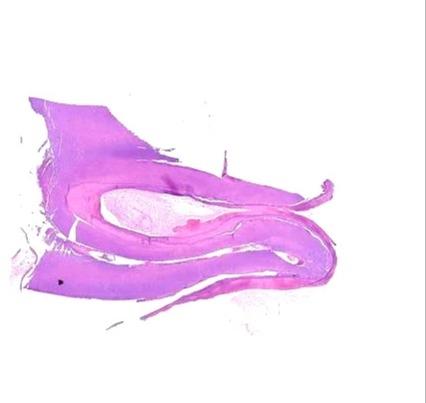 Rectangular Intertubular Dentin Oral Histology Prepared Slide, For Clinical, Laboratory, Size : Standard