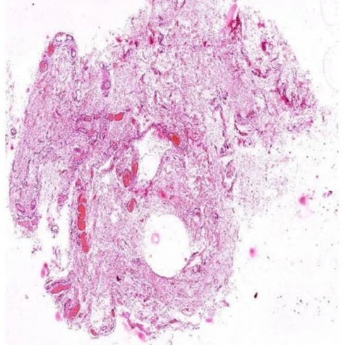 Transparent Rectangular Loose Areolar Tissue Histology Slide, For Clinical, Laboratory, Size : Standard