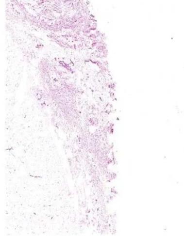 GLASS Plain Histology Slide Lung For Medical Teaching