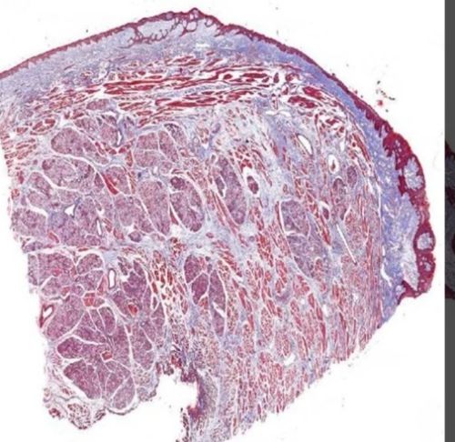 Plain Masson Trichrome Stain, For Clinical, Laboratory, Feature : Eco Friendly, Superior Quality