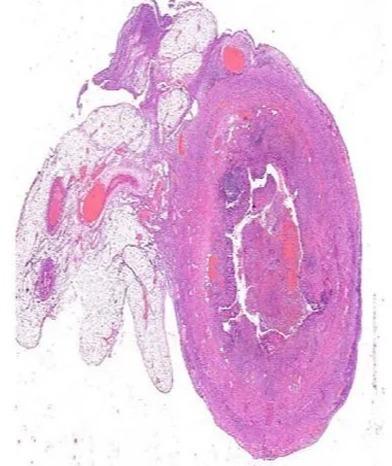 Transparent MBBS Prepared Pathology Slide Set, For Clinical, Laboratory, Size : Standard