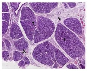 Mucin Secreting Salivary Gland Slide, For Clinical, Laboratory, Feature : Eco Friendly, Superior Quality