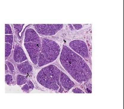 Transparent Rectangular Mucin Secreting Salivary Gland Slides, For Clinical, Laboratory, Size : Standard