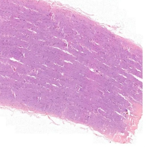 Optic Nerve Histology Prepared Slide Standard For Clinical, Laboratory