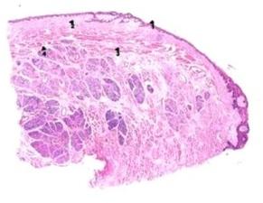 Oral Histology Dorsal Surface Of Tongue, For Clinical, Laboratory, Feature : Eco Friendly, Superior Quality