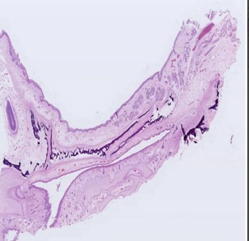 Oral Histology Hard Palate Fetal, For Clinical, Laboratory, Feature : Eco Friendly, Superior Quality