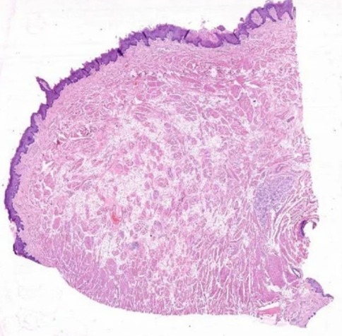 Oral Histology Slide Fungiform Papillae Tongue, For Clinical, Laboratory, Feature : Eco Friendly, Superior Quality