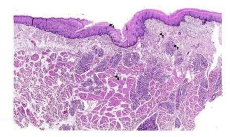 GLASS Plain Oral Mucosa Histology Slide For Clinical, Laboratory