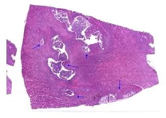 Rectangular Pathology Pyonephrosis Kidney Microscope Slide, For Clinical, Laboratory, Size : Standard
