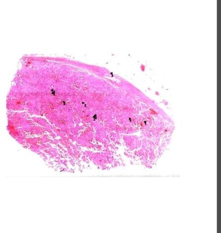 Transparent Plain Phecromocytoma Pathology Prepared Slide, For Clinical, Laboratory, Size : Standard