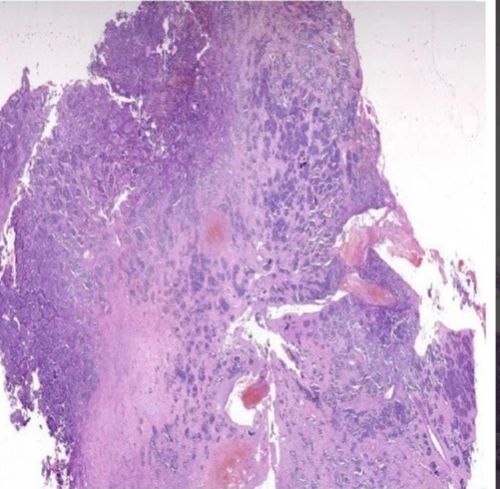 Transparent Rectangular Premalignant Disorder E Slide Sets, For Clinical, Laboratory, Size : Standard