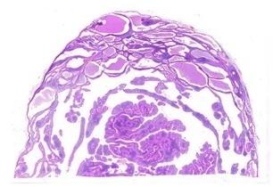 Digital Histopathology Slides Set For Clinical, Laboratory