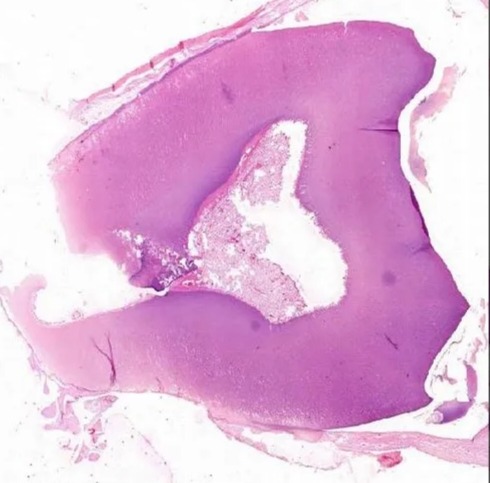 Rectangular Prepared Microscope Slide Oral Histology Slides, For Clinical, Laboratory, Size : Standard