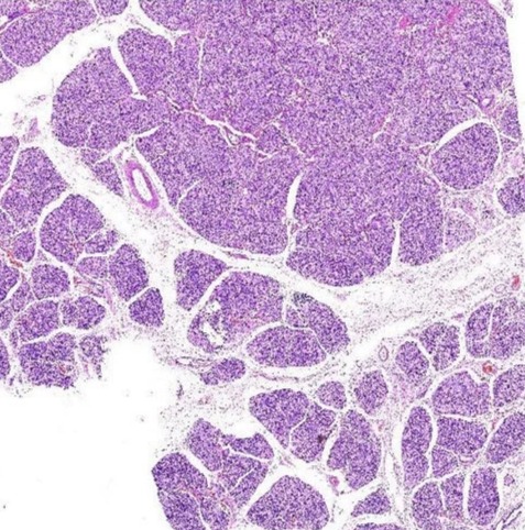 Rectangular Saliivary Gland Lesions Digital Slides Set, For Clinical, Laboratory, Size : Standard