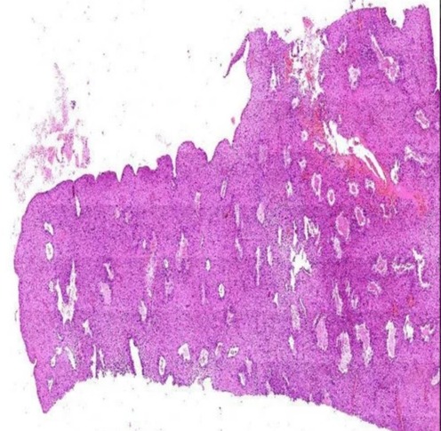 Secretory Endometrium Prepared Microscope Slides Standard For Clinical, Laboratory