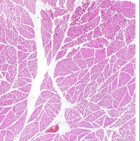 Transparent Rectangular Plain Skeletal Muscle Histology Slide, For Clinical, Laboratory, Size : Standard