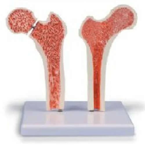 PVC Femur Bone Joint Model For Medical College