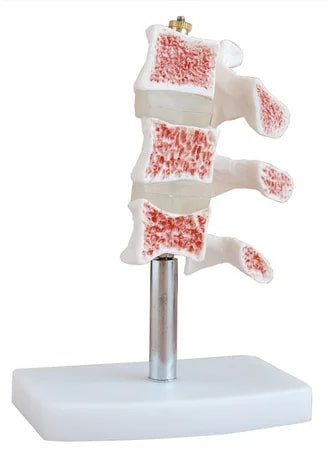 PVC Osteoporosis Bone Joint Model For Medical Institute, Nursing Institute