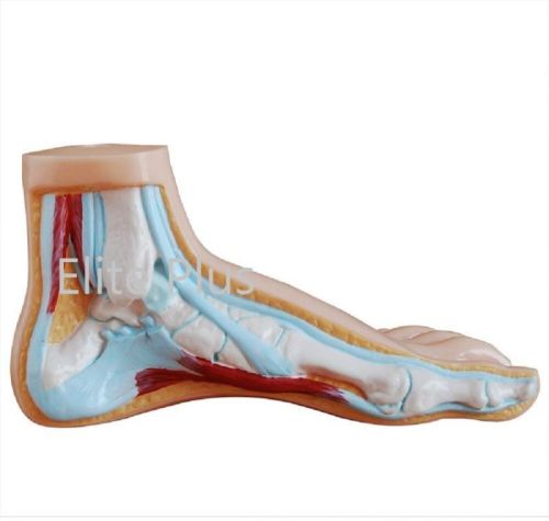 Normal, Flat and Arched Foot For Educational Use