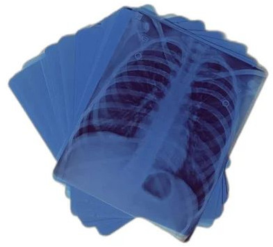 Blue X Ray Film For Hospital