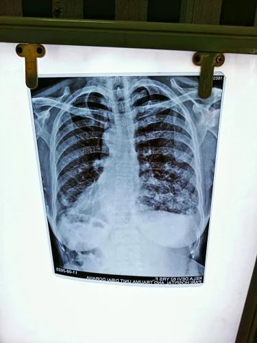 Kodak Inkjet X Ray Film For Hospital