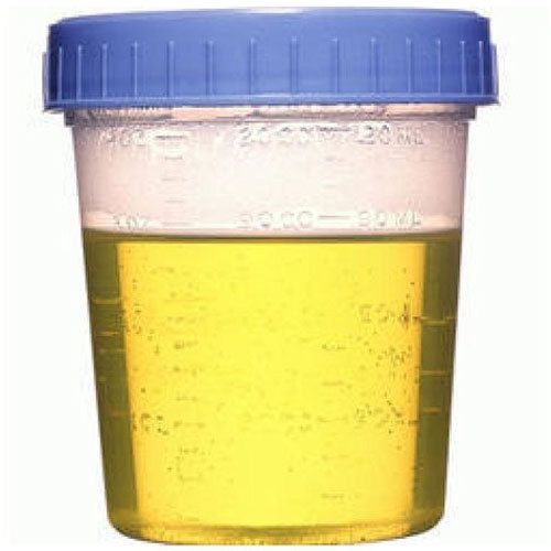 Donkey Urine, Color : Yellow, Packaging Type : Bottle For Medicine Use