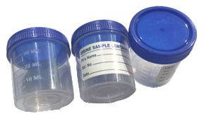 Plain Plastic Urine Container
