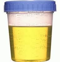 Distilled Cow Urine, Form : Liquid, Purity : 99%