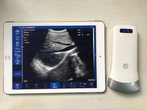 Wireless Ultrasound Scanner SY-A053CL