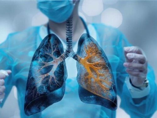 Lung Cancer Treatment Service